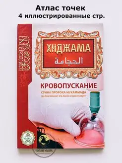 Хиджама (кровопускание)